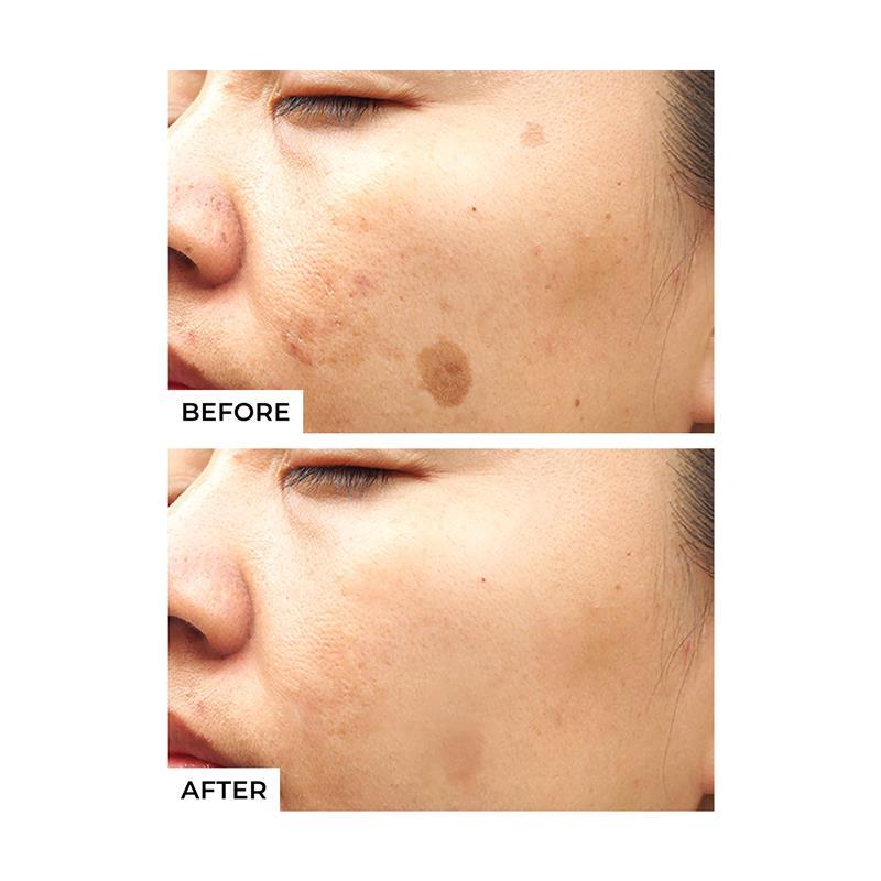 Freezeframe Pigment Clear Face Solutions 25ml