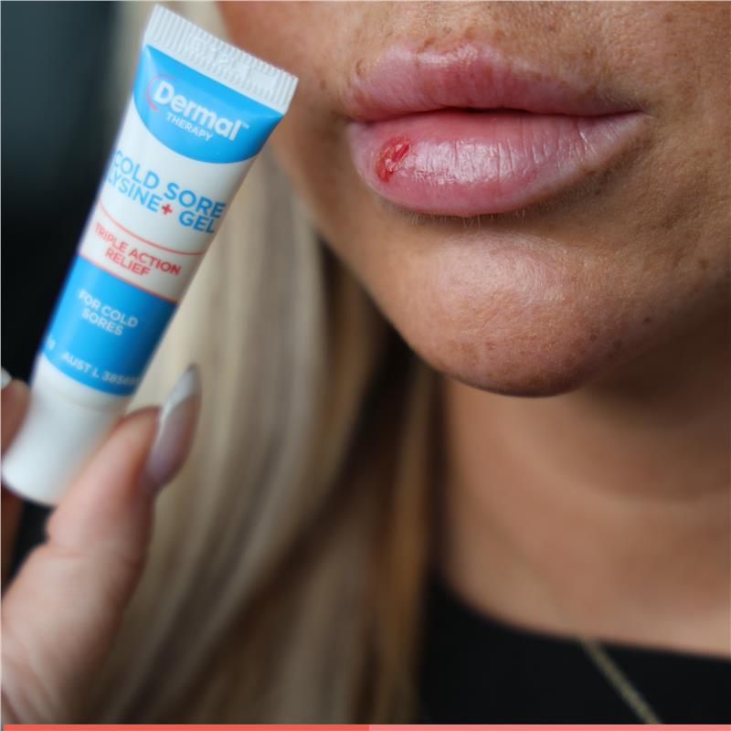 Dermal Therapy Cold Sore Lysine+ Gel 5g
