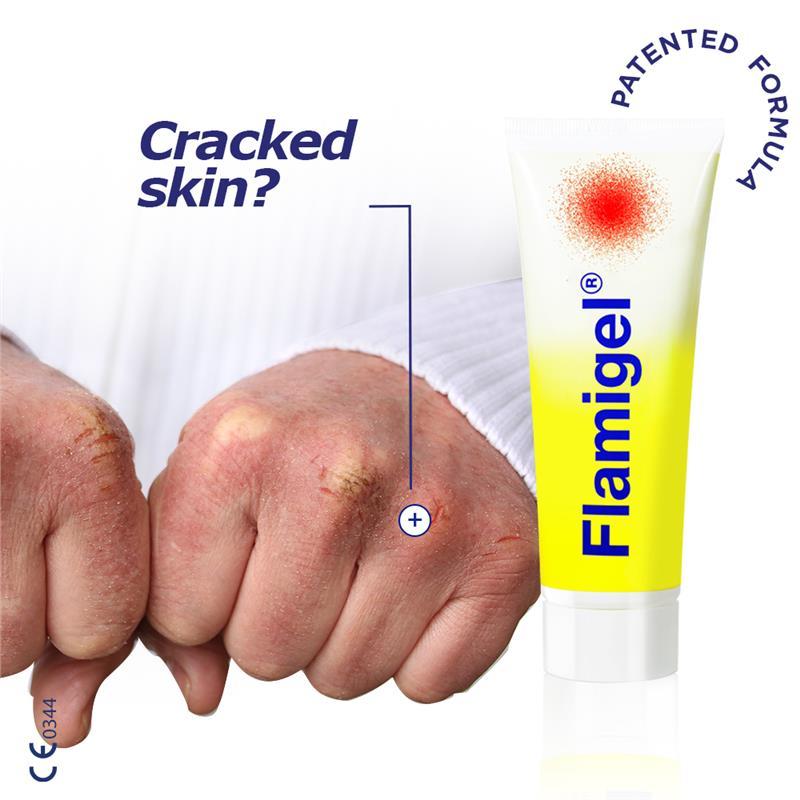 Flamigel 50g