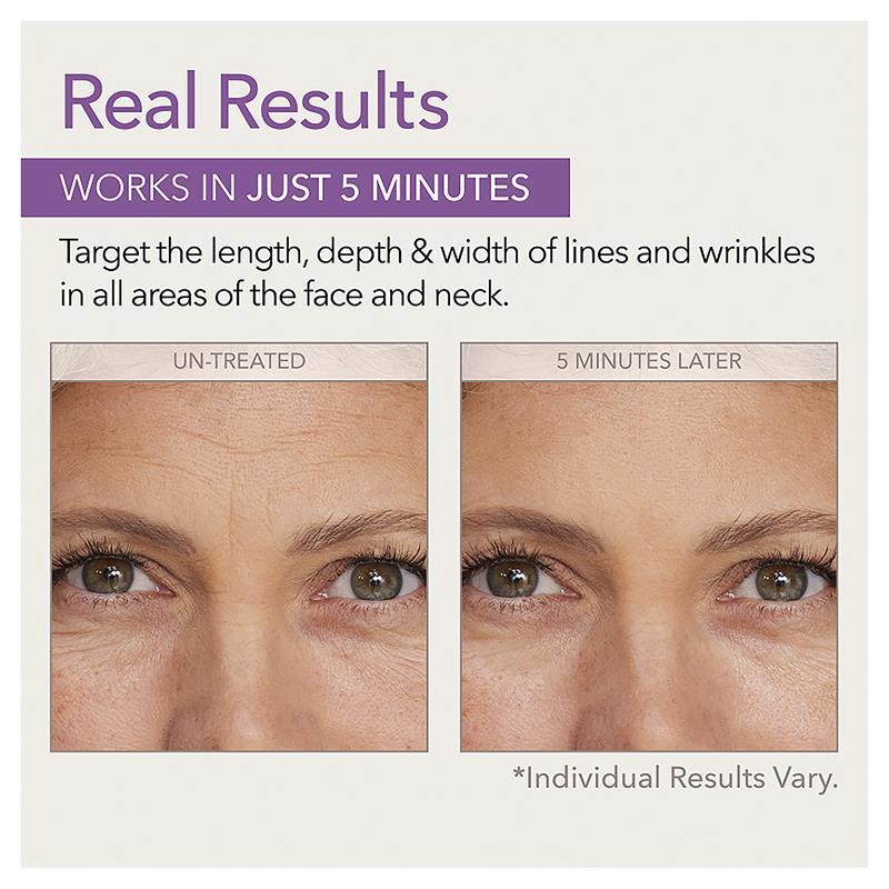 Skin Doctors Instant Wrinkle Filler 10ml