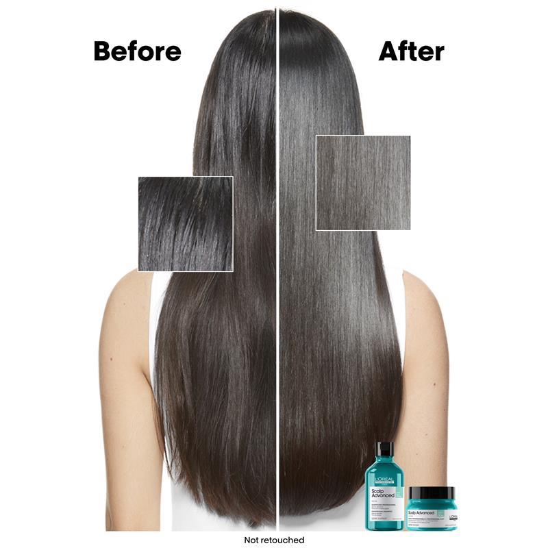 L'Oreal Professionnel Serie Expert Scalp Advanced Anti Oily Shampoo 300ml