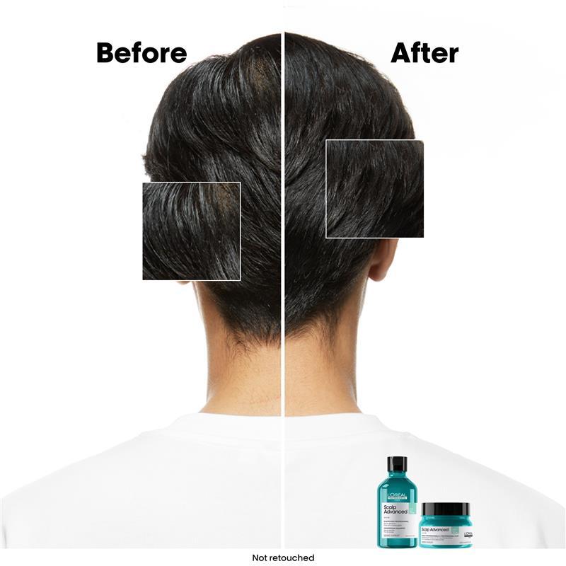 L'Oreal Professionnel Serie Expert Scalp Advanced Anti Oily Shampoo 300ml