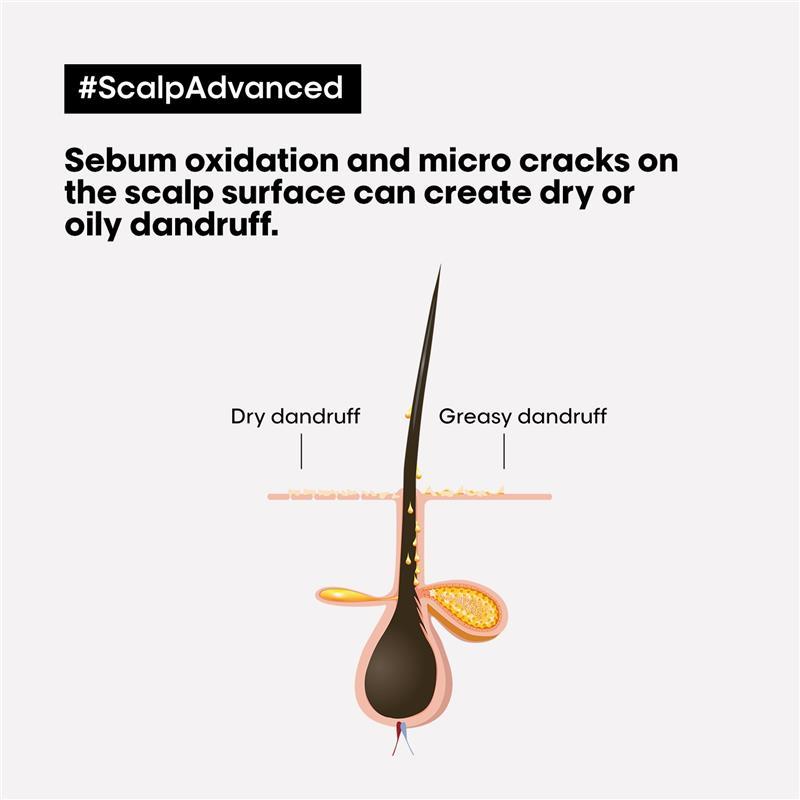 L'Oreal Professionnel Serie Expert Scalp Advanced Anti Dandruff Shampoo 300ml