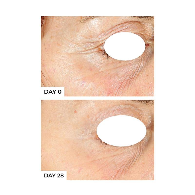 Freezeframe Pro-Collagen Sunceutical