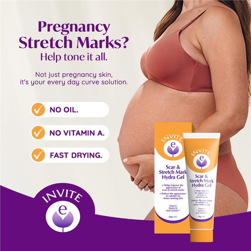 Invite E Scar & Stretch Mark Gel 50g