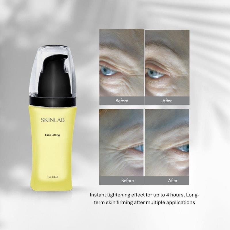 SKINLAB Face Lifting Serum 30ml