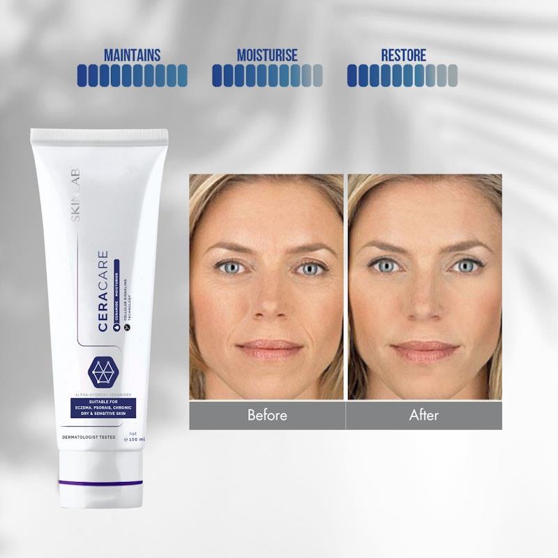 SKINLAB Ceracare Moisturiser 100ml