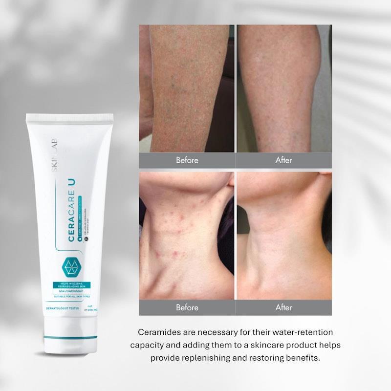 SKINLAB Ceracare U Moisturiser 100ml