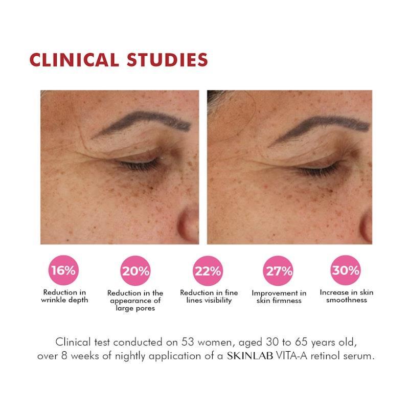 SKINLAB VITA-A Retinol Serum 30ml
