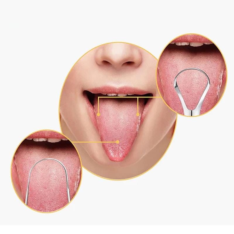 Caremax 3 Pieces Stainless Steel Tongue Scraper with Case Pack