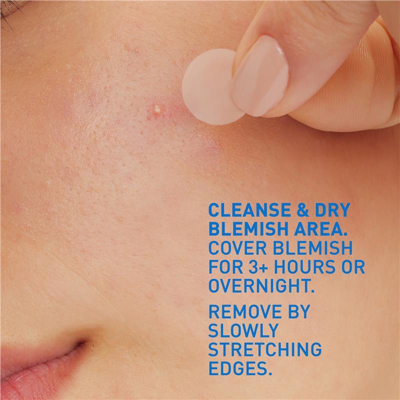 Cerave Blemish Barrier Patches