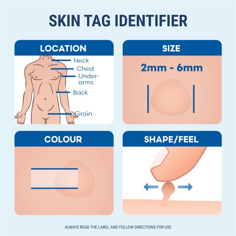 Duofilm Skin Tag Treatment 50ml