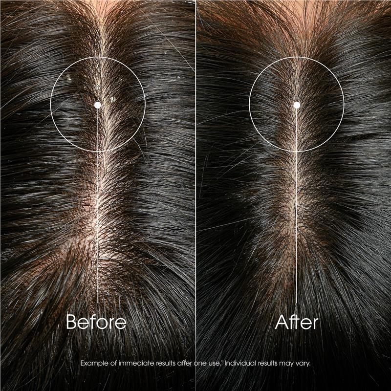 Klorane Anti-Dandruff Rebalancing & Treating Shampoo With Galangal 400ml