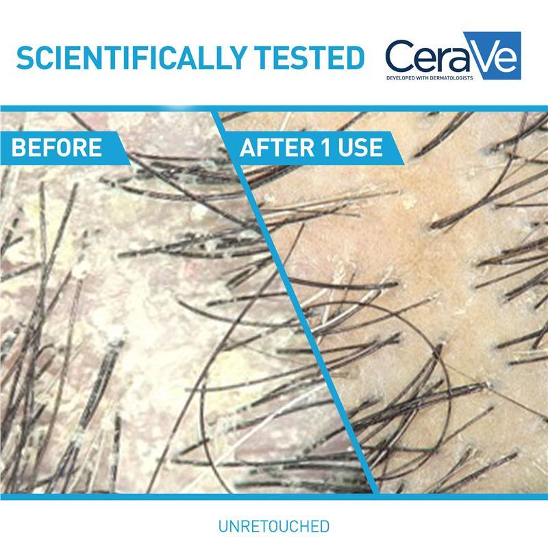 CeraVe Hair 2in1 Anti-Dandruff Hydrating Shampoo and Conditioner 355ml