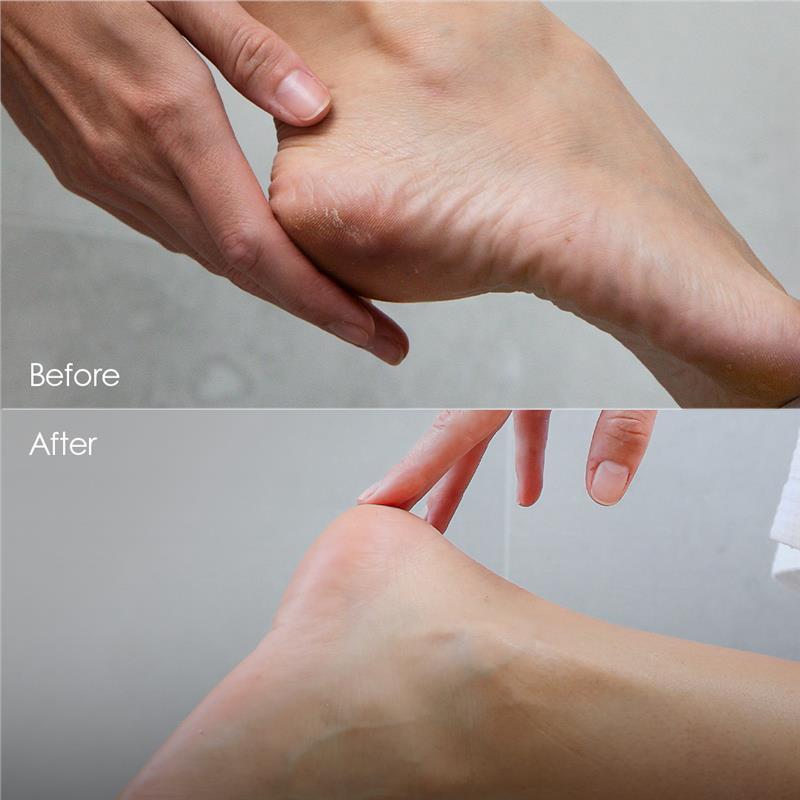 Manicare Foot Callus Razor 25009