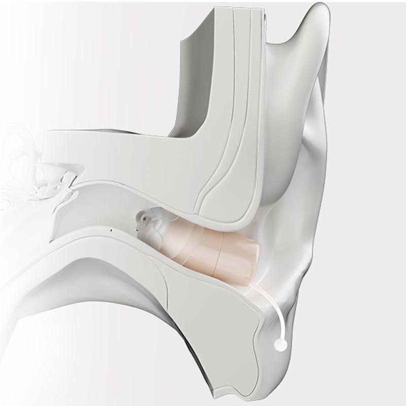 Ceretone Core One Pro Invisible In Canal Hearing Aid - Beige 1 Pair