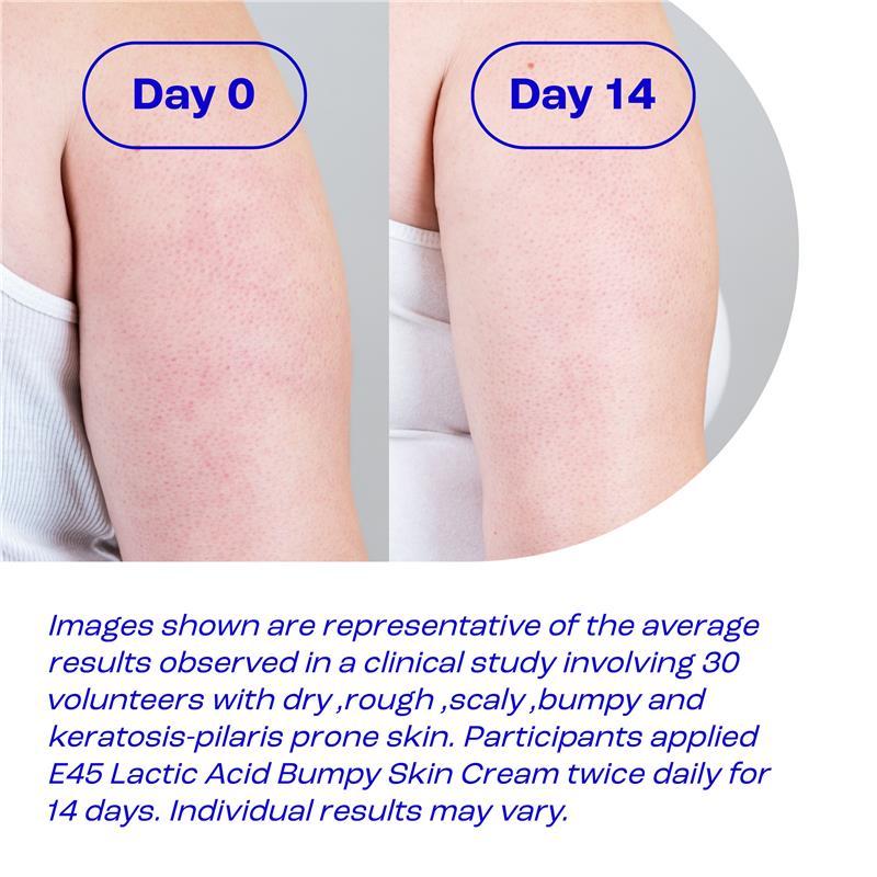 E45 Lactic Acid Bumpy Skin Cream 100g