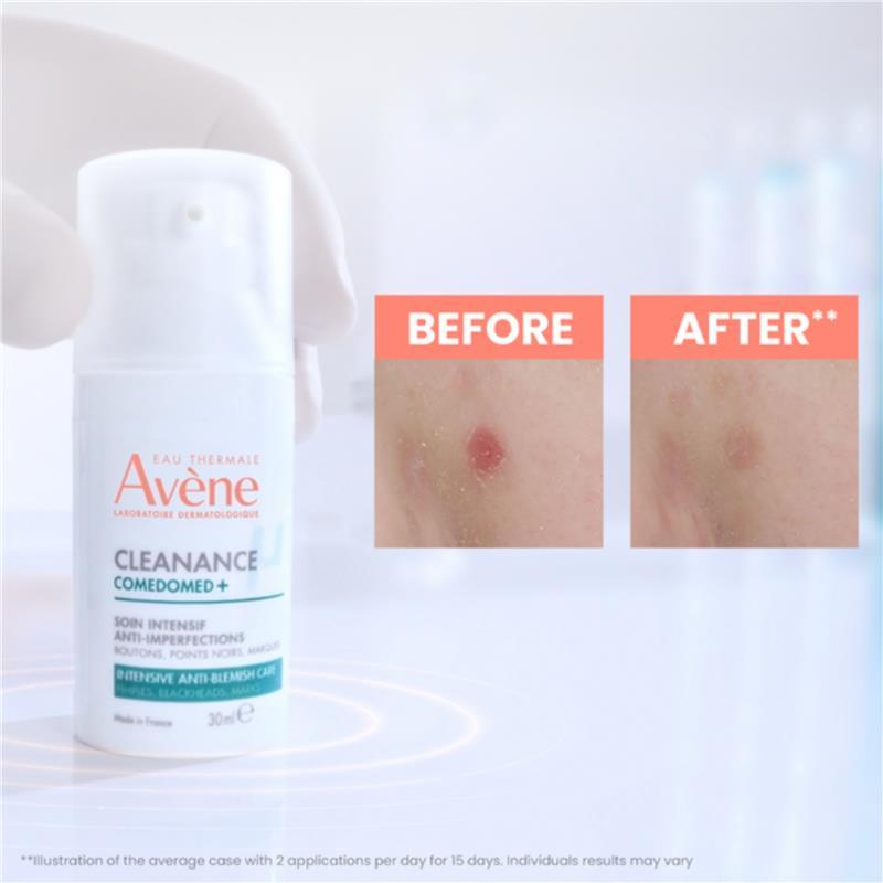 Avene Cleanance Comedomed+ Intensive Anti-Blemish Care 30ml