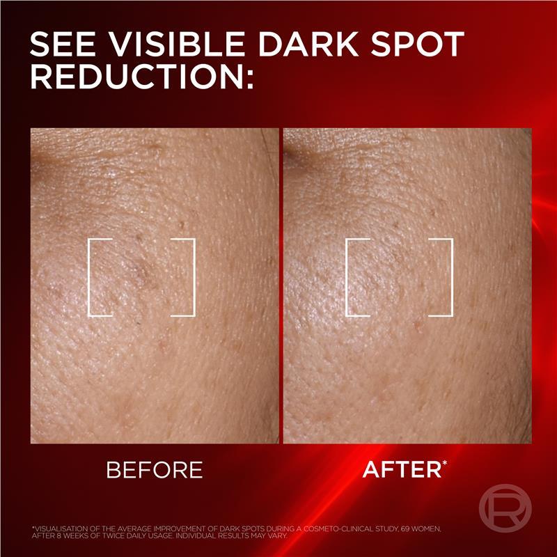 L'Oreal Paris Revitalift Laser Dark Spot Creamy-Serum 50ml