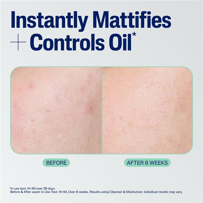 Cetaphil Mattifying Blemish Moisturiser 100ml