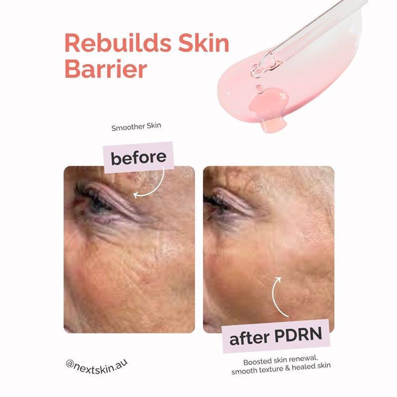 NextSkin Pulse Renew 20ml