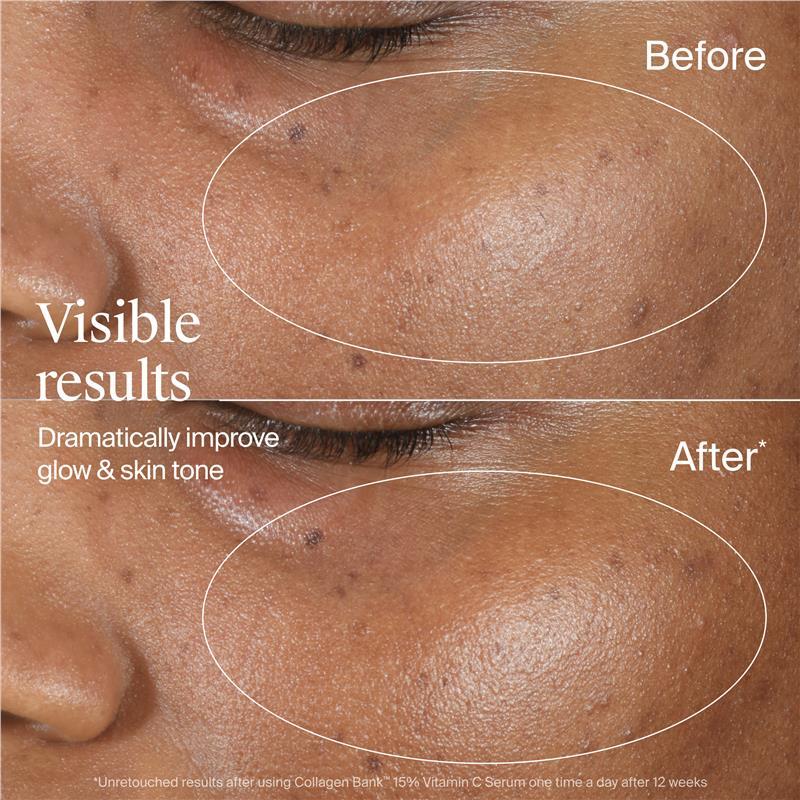 Neutrogena Collagen Bank 15% Vitamin C Serum 14ml