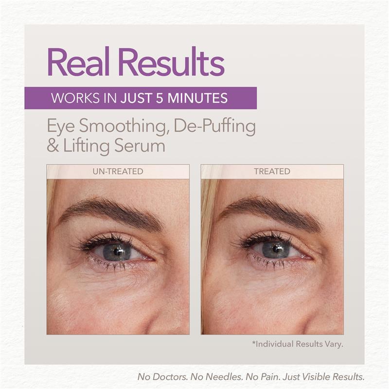 Skin Doctors Instant Eyelift 10ml